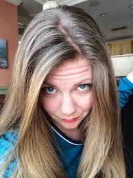 grey hair issues